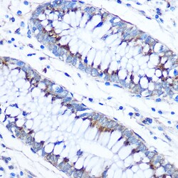 Invitrogen FAM3D Polyclonal Antibody 100 &mu;L; Unconjugated:Antibodies,