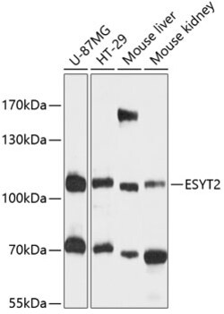 Invitrogen FAM62B Polyclonal Antibody 100 &mu;L; Unconjugated:Antibodies,