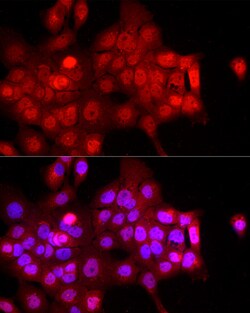 Invitrogen FBXW11 Polyclonal Antibody 100 μL; Unconjugated:Antibodies,