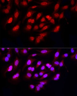 Invitrogen FBXW11 Polyclonal Antibody 100 μL; Unconjugated:Antibodies,