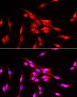 Invitrogen FBXW11 Polyclonal Antibody 100 μL; Unconjugated:Antibodies,