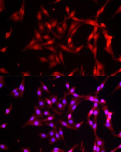 Invitrogen FBXW11 Polyclonal Antibody 100 μL; Unconjugated:Antibodies,