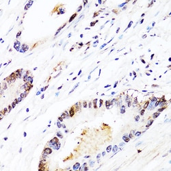 Invitrogen FGF12 Polyclonal Antibody 100 &mu;L | Buy Online | Invitrogen&trade; | Fisher Scientific
