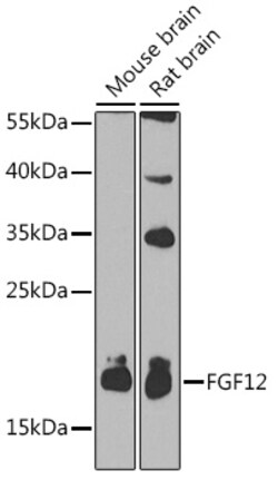Invitrogen FGF12 Polyclonal Antibody 100 &mu;L | Buy Online | Invitrogen&trade; | Fisher Scientific