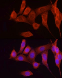 Invitrogen FGF17 Polyclonal Antibody 100 &mu;L; Unconjugated:Antibodies,