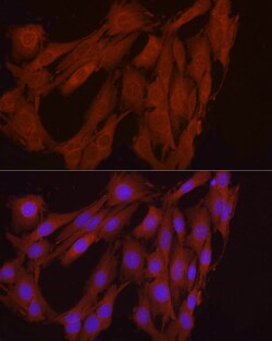 Invitrogen FGF17 Polyclonal Antibody 100 &mu;L; Unconjugated:Antibodies,