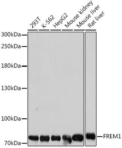 Invitrogen FREM1 Polyclonal Antibody 100 &mu;L; Unconjugated:Antibodies,
