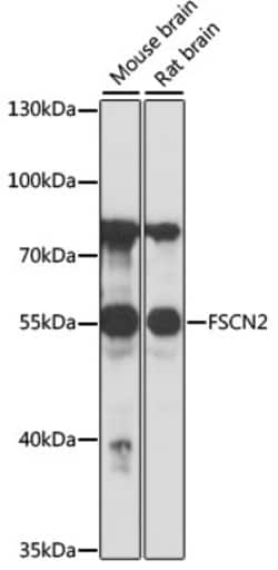 Invitrogen FSCN2 Polyclonal Antibody 100 &mu;L; Unconjugated:Antibodies,