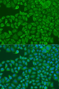 Invitrogen FXR2 Polyclonal Antibody 100 &mu;L; Unconjugated:Antibodies,