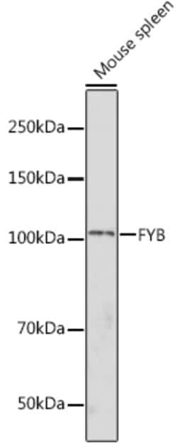 ADAP Polyclonal Antibody:Antibodies, Polyclonal