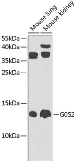 Invitrogen G0S2 Polyclonal Antibody 100 &mu;L; Unconjugated:Antibodies,