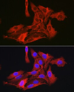 Invitrogen G6PC3 Polyclonal Antibody 100 &mu;L; Unconjugated:Antibodies,