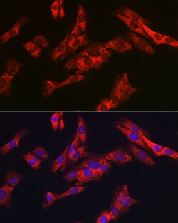 Invitrogen G6PC3 Polyclonal Antibody 100 &mu;L; Unconjugated:Antibodies,