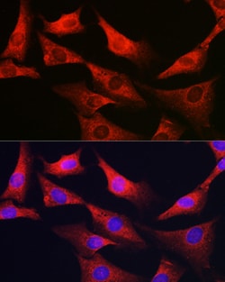 Invitrogen G6PC3 Polyclonal Antibody 100 &mu;L; Unconjugated:Antibodies,