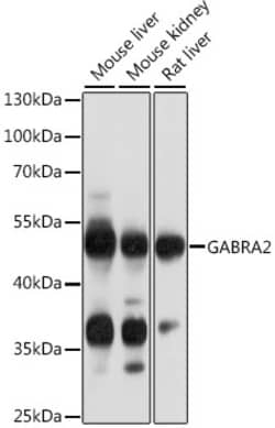 Invitrogen GABRA2 Polyclonal Antibody 100 &mu;L; Unconjugated:Antibodies,