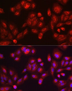 Invitrogen GALC Polyclonal Antibody 100 &mu;L; Unconjugated:Antibodies,