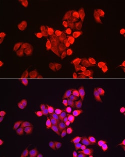 Invitrogen GALC Polyclonal Antibody 100 &mu;L; Unconjugated:Antibodies,