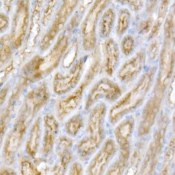 Invitrogen GALC Polyclonal Antibody 100 &mu;L; Unconjugated:Antibodies,