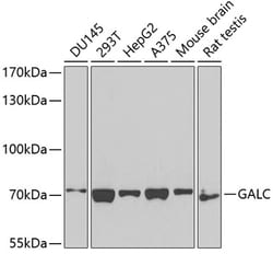 Invitrogen GALC Polyclonal Antibody 100 &mu;L; Unconjugated:Antibodies,