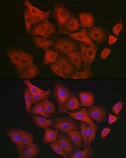Invitrogen GART Polyclonal Antibody 100 μL; Unconjugated:Antibodies,