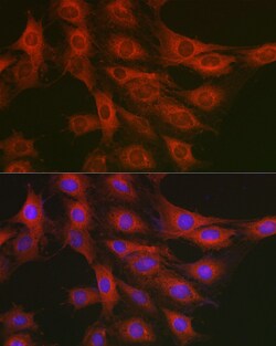 Invitrogen GART Polyclonal Antibody 100 μL; Unconjugated:Antibodies,
