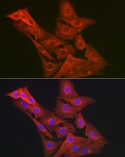Invitrogen GART Polyclonal Antibody 100 μL; Unconjugated:Antibodies,