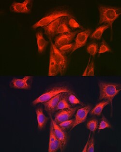 Invitrogen GART Polyclonal Antibody 100 μL; Unconjugated:Antibodies,