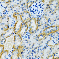 Invitrogen GDAP1 Polyclonal Antibody 100 μL; Unconjugated:Antibodies,