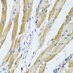 Invitrogen GDAP1 Polyclonal Antibody 100 μL; Unconjugated:Antibodies,