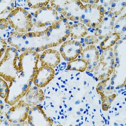 Invitrogen GDAP1 Polyclonal Antibody 100 μL; Unconjugated:Antibodies,