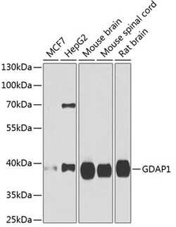 Invitrogen GDAP1 Polyclonal Antibody 100 μL; Unconjugated:Antibodies,