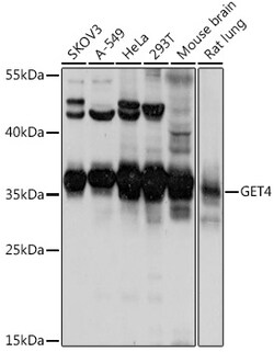Invitrogen C7orf20 Polyclonal Antibody 100 μL; Unconjugated:Antibodies,
