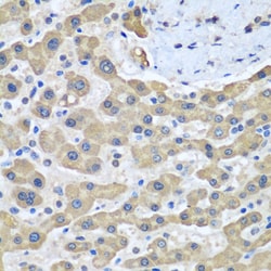 Invitrogen GFM1 Polyclonal Antibody 100 &mu;L; Unconjugated:Antibodies,