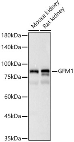 Invitrogen GFM1 Polyclonal Antibody 100 &mu;L; Unconjugated:Antibodies,