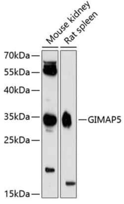 Invitrogen GIMAP5 Polyclonal Antibody 100 &mu;L | Buy Online | Invitrogen&trade; | Fisher Scientific