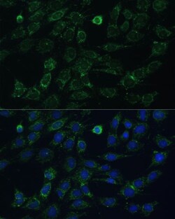 Invitrogen GK2 Polyclonal Antibody 100 &mu;L | Buy Online | Invitrogen&trade; | Fisher Scientific
