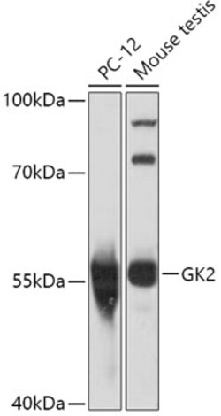 Invitrogen GK2 Polyclonal Antibody 100 &mu;L | Buy Online | Invitrogen&trade; | Fisher Scientific