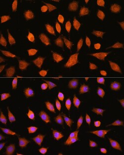 Invitrogen PI4KA Polyclonal Antibody 100 μL; Unconjugated:Antibodies,