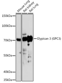 Invitrogen Glypican 3 Polyclonal Antibody 100 &mu;L | Buy Online | Invitrogen&trade; | Fisher Scientific