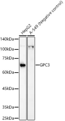 Invitrogen Glypican 3 Polyclonal Antibody 100 &mu;L | Buy Online | Invitrogen&trade; | Fisher Scientific