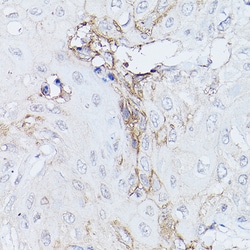 Invitrogen GNA11 Polyclonal Antibody 100 μL; Unconjugated:Antibodies,