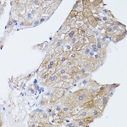 Invitrogen GNA11 Polyclonal Antibody 100 μL; Unconjugated:Antibodies,