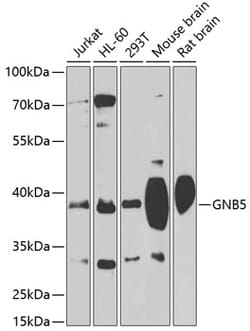 Invitrogen GNB5 Polyclonal Antibody 100 &mu;L; Unconjugated:Antibodies,