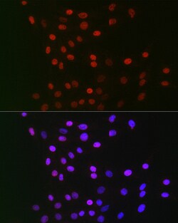 Invitrogen GPS1 Polyclonal Antibody 100 &mu;L | Buy Online | Invitrogen&trade; | Fisher Scientific