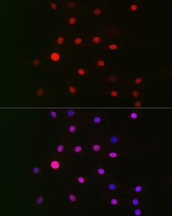 Invitrogen GPS1 Polyclonal Antibody 100 &mu;L | Buy Online | Invitrogen&trade; | Fisher Scientific