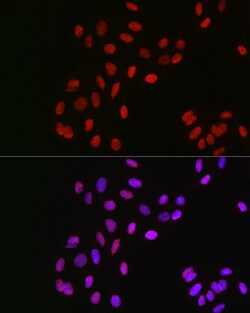 Invitrogen GPS1 Polyclonal Antibody 100 &mu;L | Buy Online | Invitrogen&trade; | Fisher Scientific