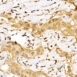 Invitrogen GPS1 Polyclonal Antibody 100 &mu;L | Buy Online | Invitrogen&trade; | Fisher Scientific