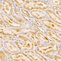 Invitrogen GPS1 Polyclonal Antibody 100 &mu;L | Buy Online | Invitrogen&trade; | Fisher Scientific