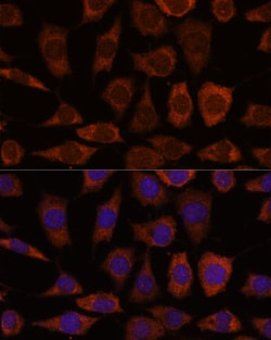 Invitrogen GRHPR Polyclonal Antibody 100 μL; Unconjugated:Antibodies,