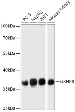 Invitrogen GRHPR Polyclonal Antibody 100 μL; Unconjugated:Antibodies,